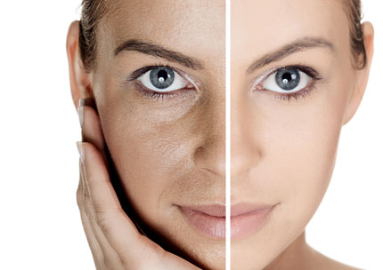 PRP ili PLATELET RICH PLASMA